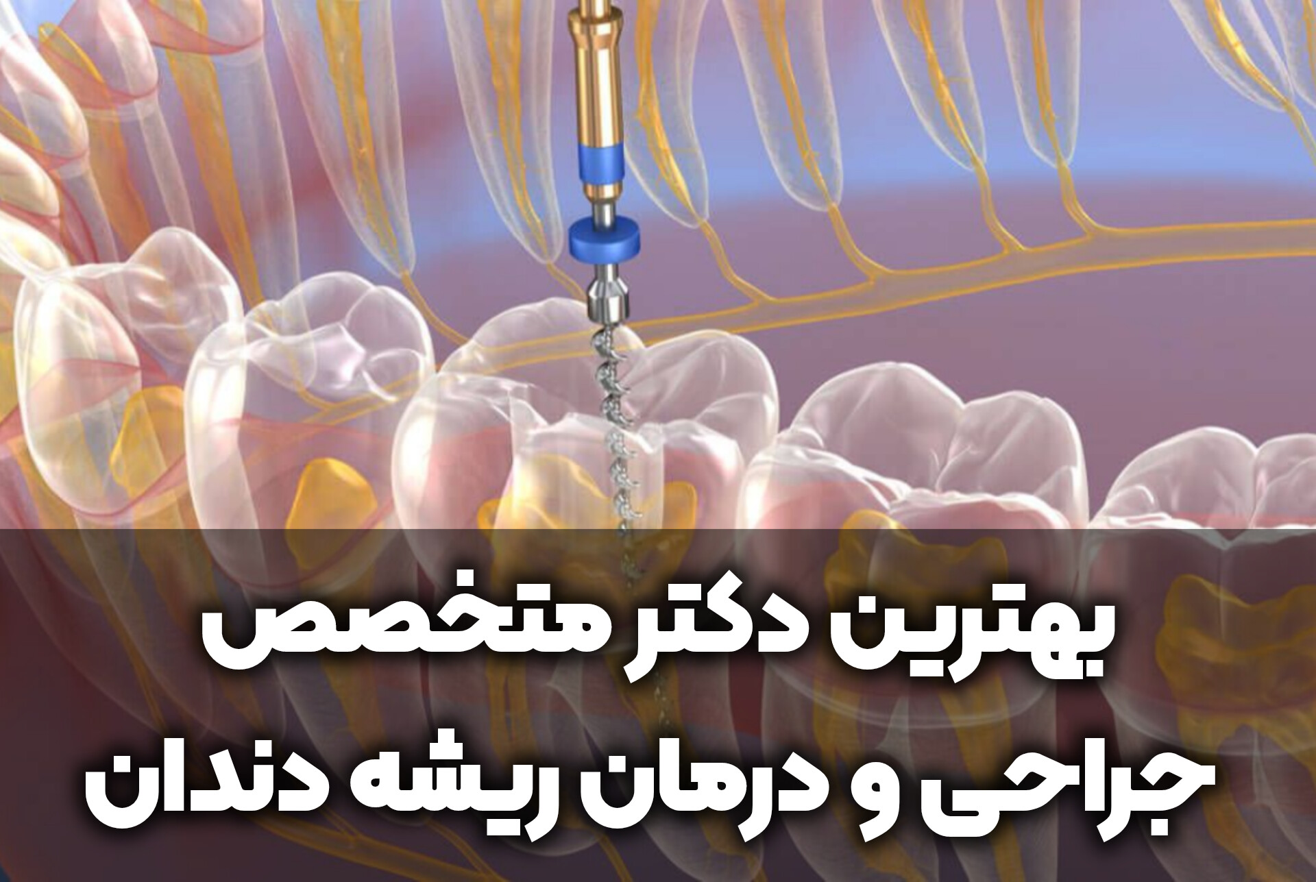 دنتارو بهترین دکتر متخصص جراحی و درمان ریشه دندان