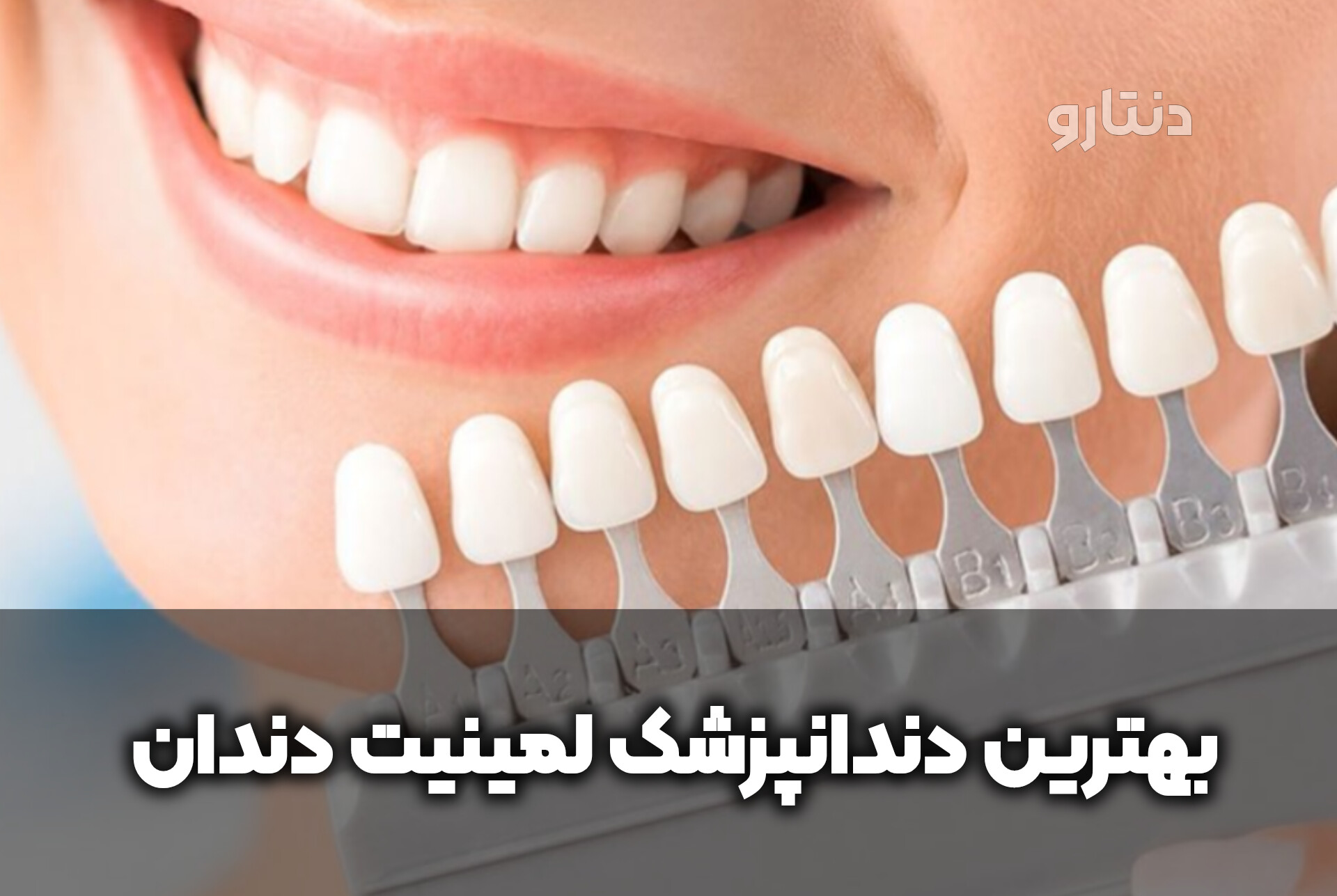 دنتارو بهترین دندانپزشک لمینت دندان